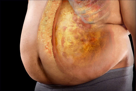 Schnitt durch den Bauch mit sichtbarem Magen, Leber und Magen-Darm-Trakt, zeigt innere Organe in realistischem Detail.