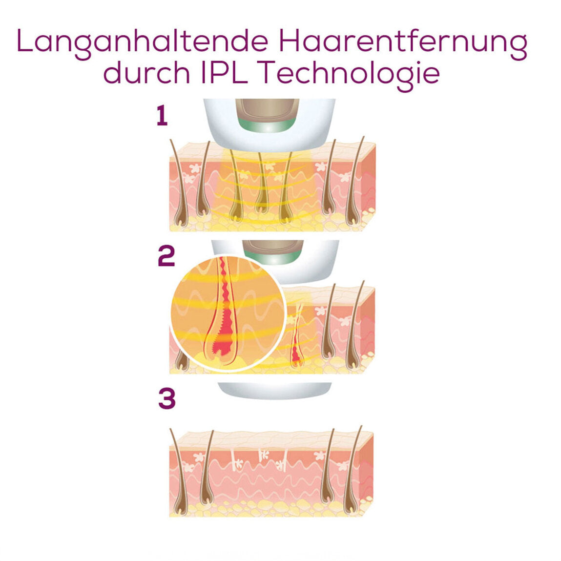 Beurer IPL 5800 Pure Skin Pro